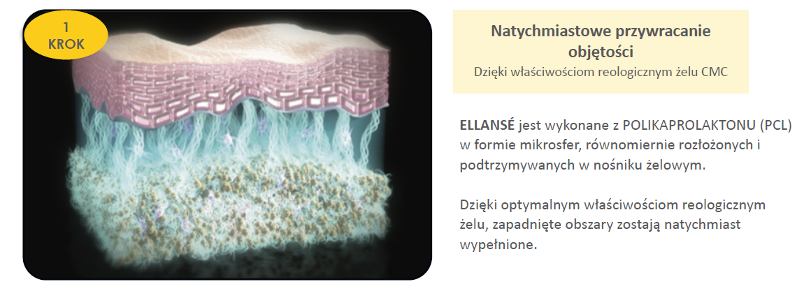 Działanie preparatu ELLANSE - krok 1