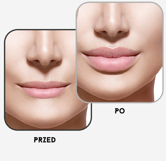 Modelowanie kształtu ust